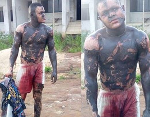 Man Gets Badly Burnt While Allegedly Trying To Steal From A Transformer (Graphic Photos/Video)