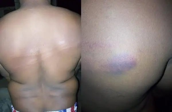 Coronavirus lockdown: NTA staff allegedly brutalized by soldiers in Ondo
