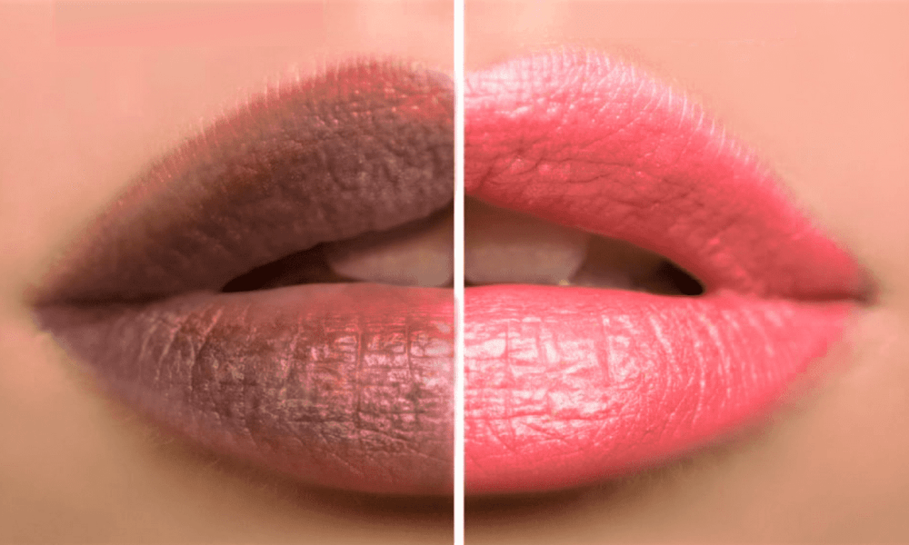 Ways To Get Soft And Pink Lips Naturally Simple Homemade