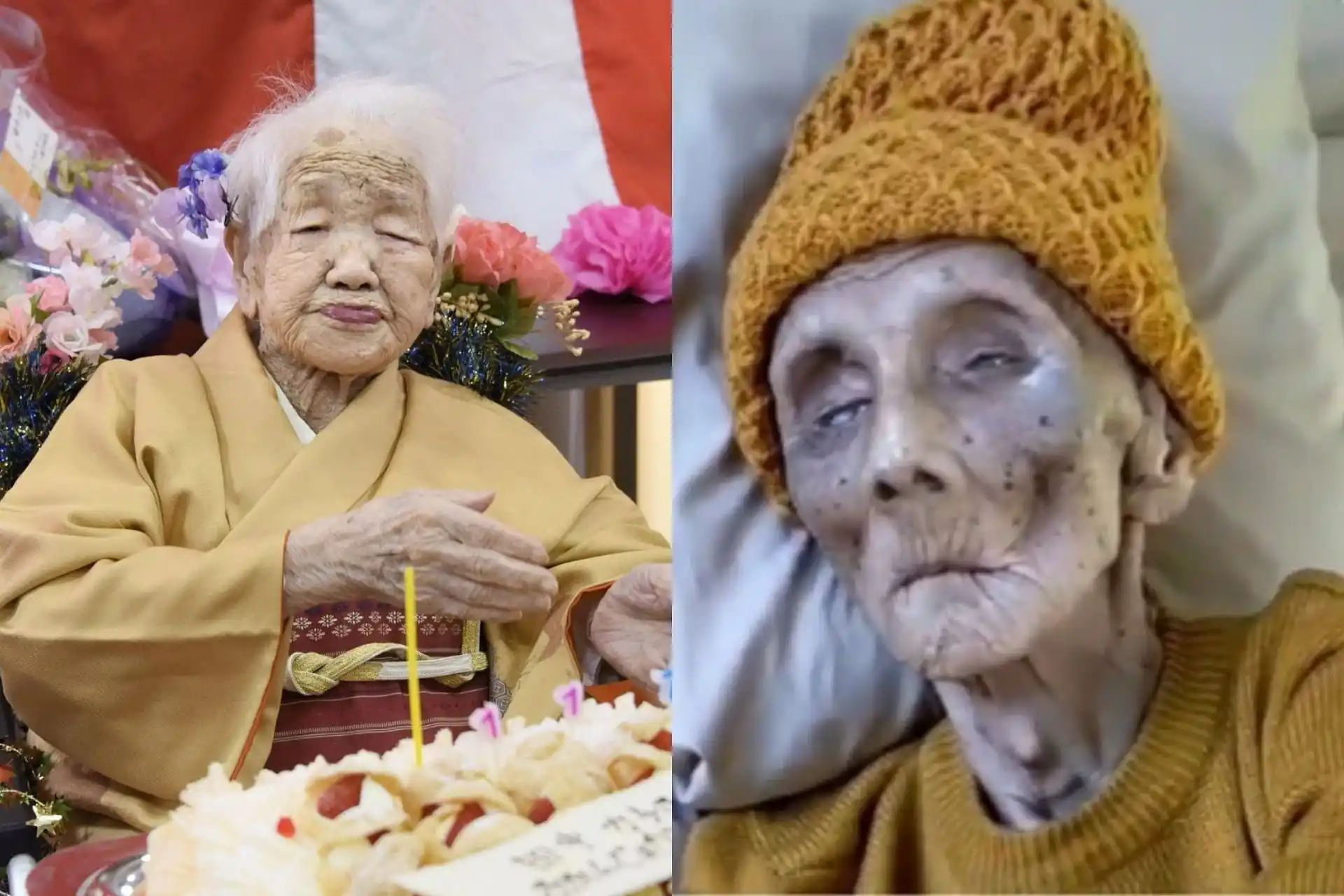 399 Year Old Woman