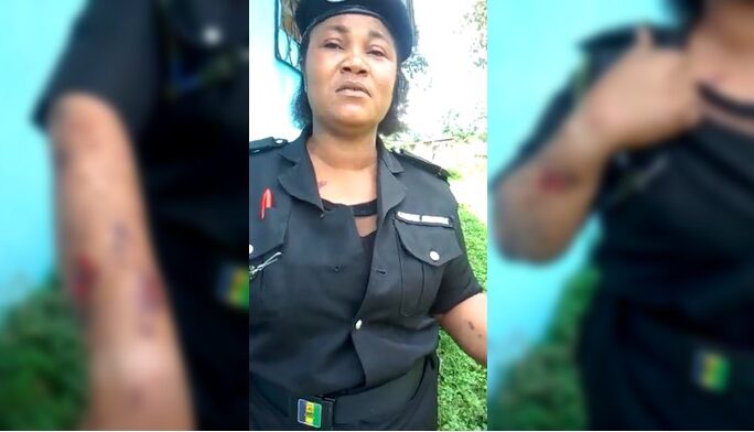 Policewoman shows bodily injuries