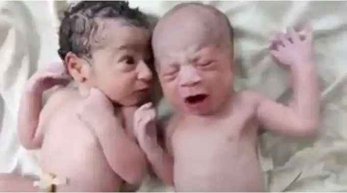 New Born Baby Shock Face
