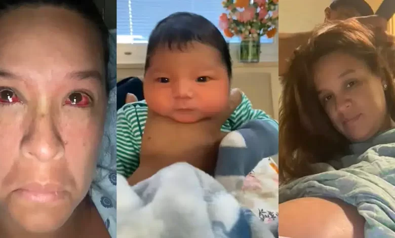 birth baby explodes blood vessels of her eyes